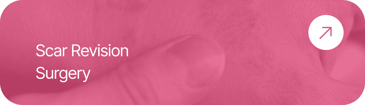 ScarRev