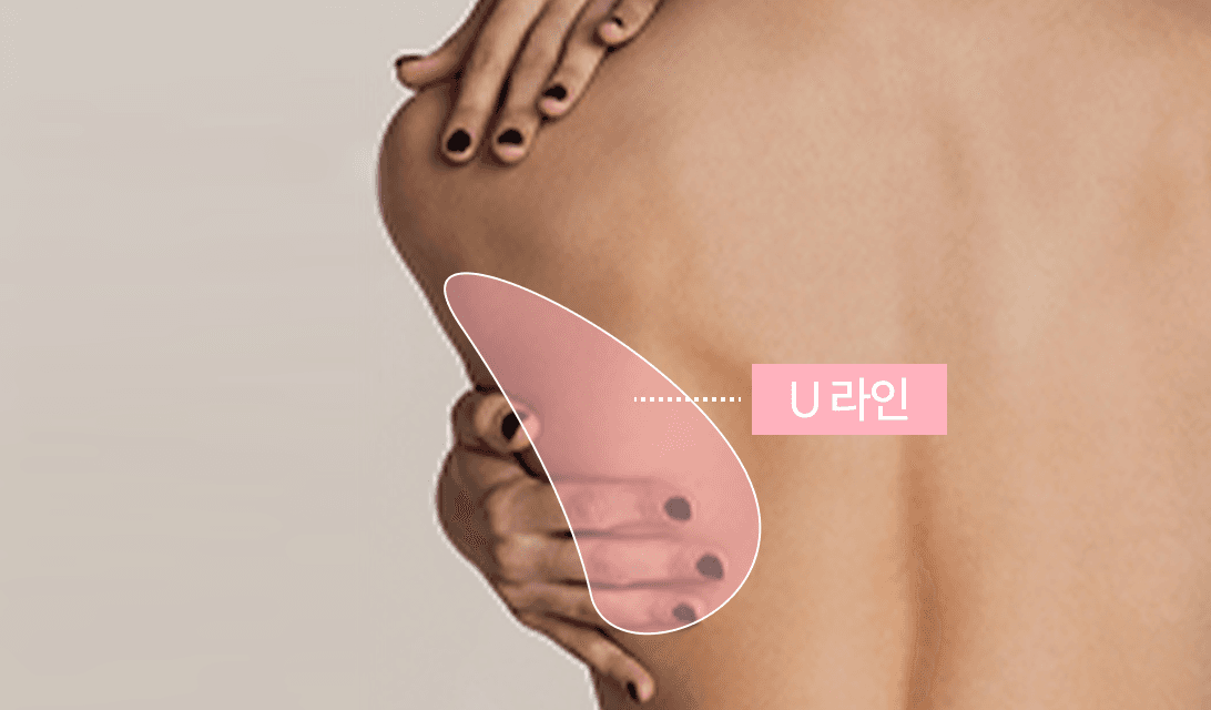 3번