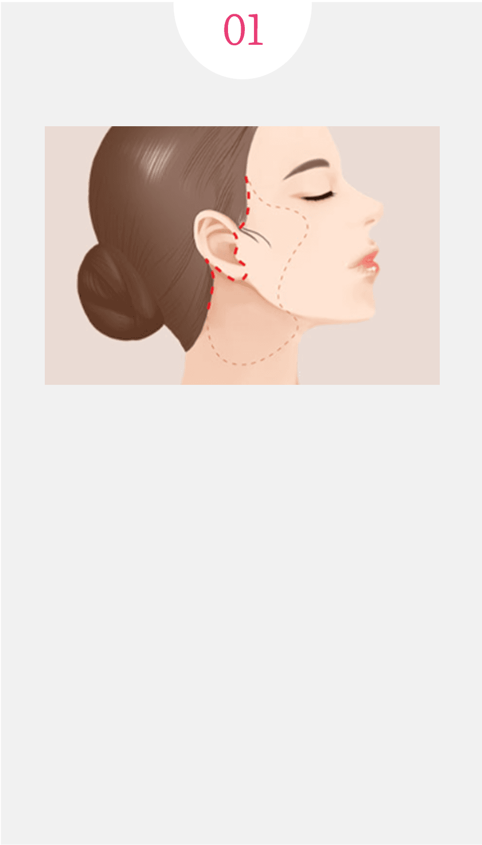 다른첫시작