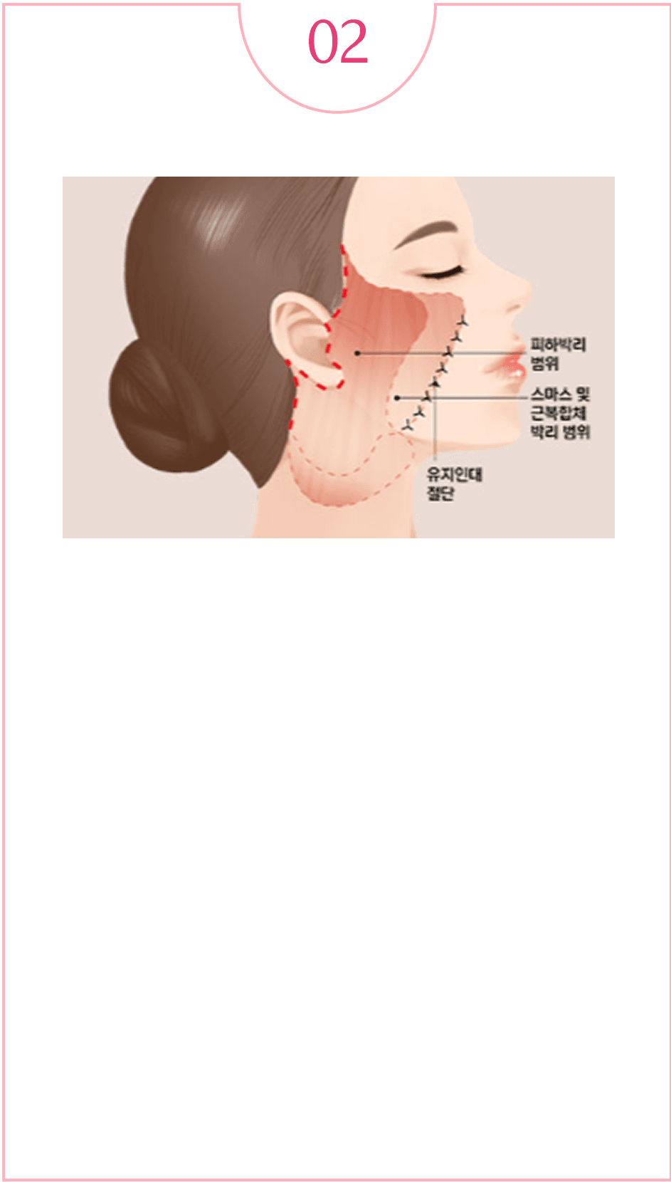 다른첫시작