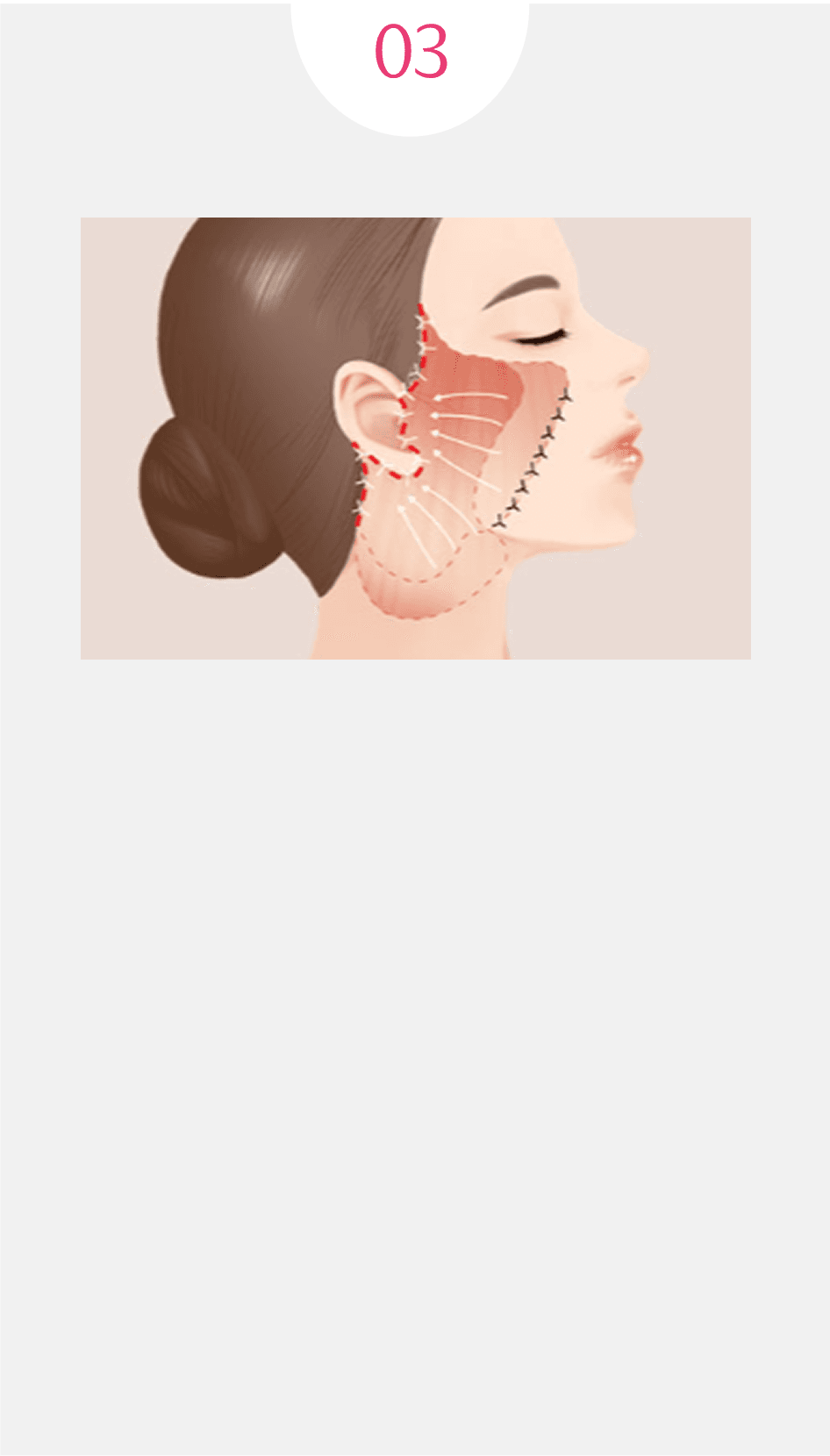 다른첫시작
