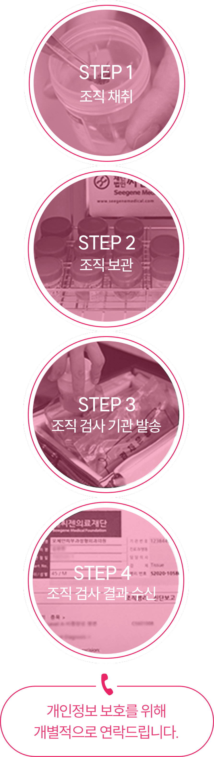 조기제거