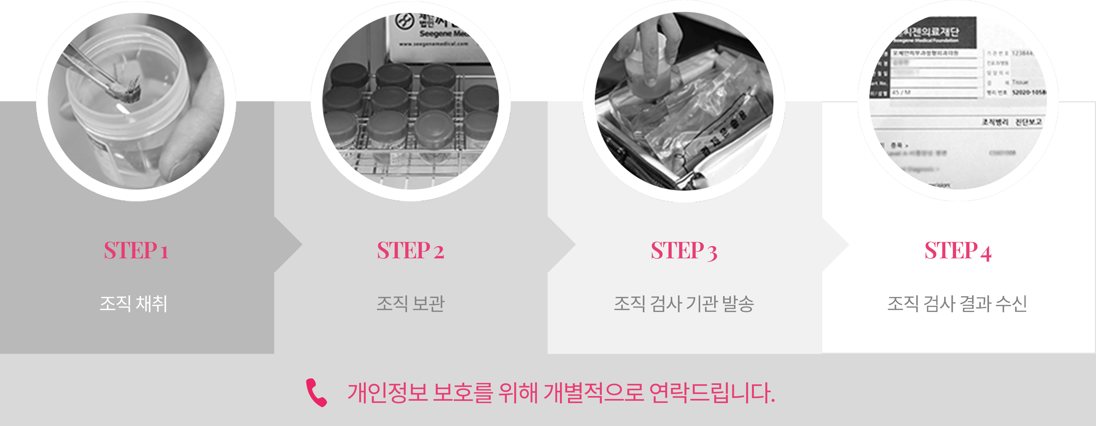 조기제거