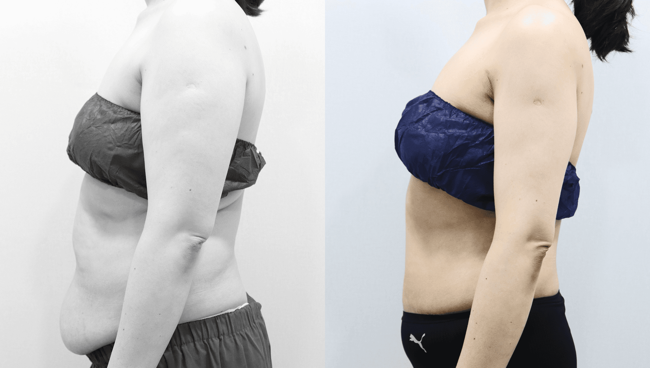 before-after-1