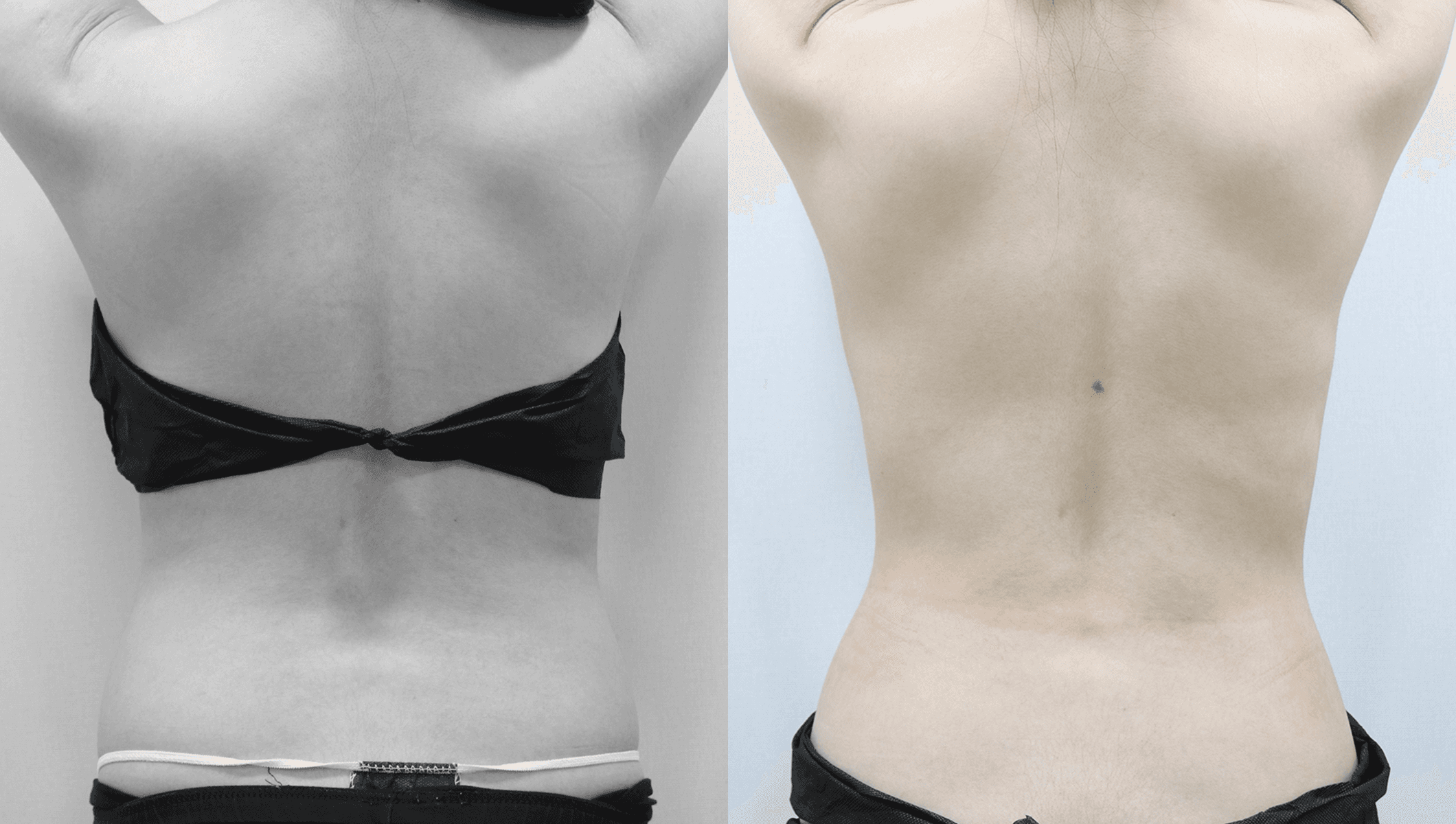 before-after-2