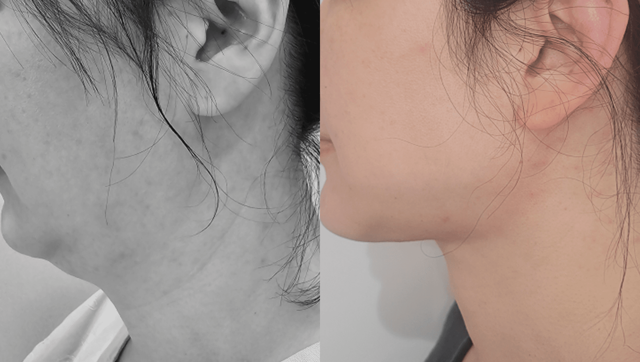 before-after-4